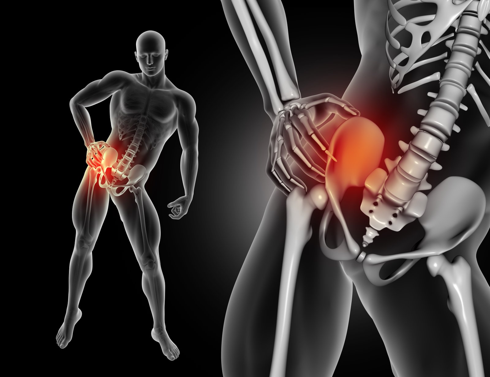 Hip Replacement Surgery: What Patients Should Expect Before, During & After