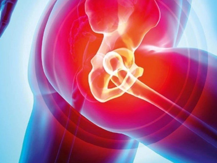Hip replacement specialist in Delhi