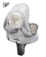 total knee replacement implant